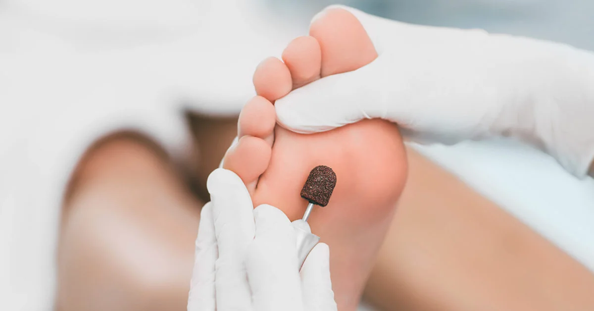 Signs You Should See a Podiatrist