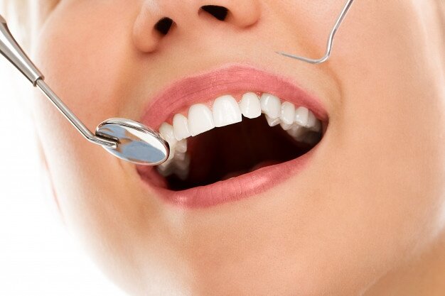 Discover How to Avoid and Treat Dental Problems