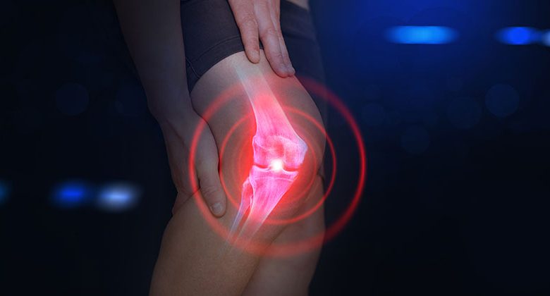 Demystifying Knee Pain