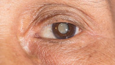 Cataract Treatment