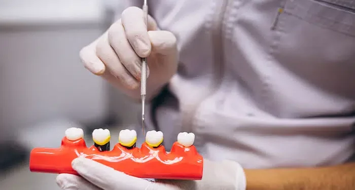 Dental Implants Melbourne for Patients with underlying Medical Conditions