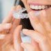 Myths about invisible aligners debunked