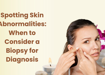 Spotting Skin Abnormalities
