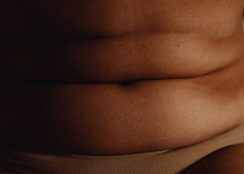 Gastric Bypass Surgery