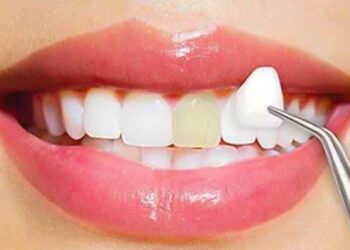 Cosmetic Dentistry Costs