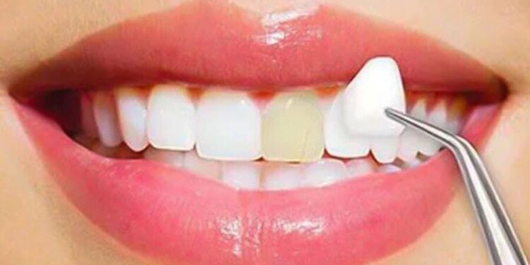 Cosmetic Dentistry Costs