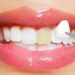Cosmetic Dentistry Costs