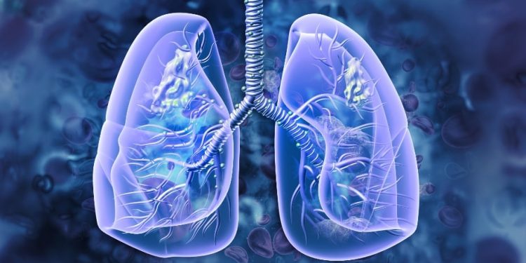 Managing Lung Issues