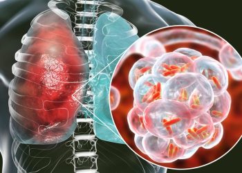 Mycoplasma, the bacteria behind recent pneumonia outbreaks in Ohio and abroad