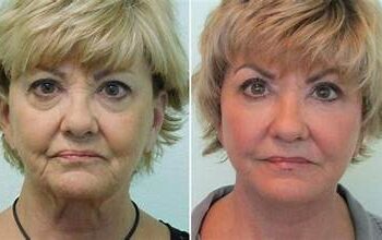 How Much Does a Facial Cost?