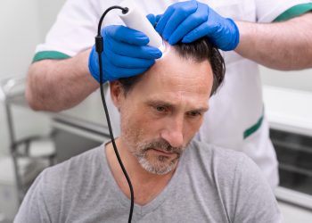Assessing Your Hair Loss: Understanding and Managing Alopecia with Modern Tools