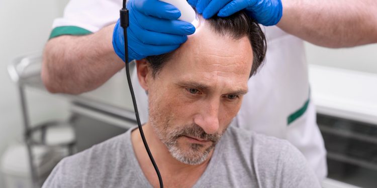 Assessing Your Hair Loss: Understanding and Managing Alopecia with Modern Tools