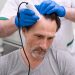 Assessing Your Hair Loss: Understanding and Managing Alopecia with Modern Tools