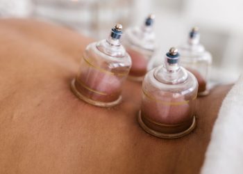 Understanding the Healing Art of Hijama (Wet Cupping)