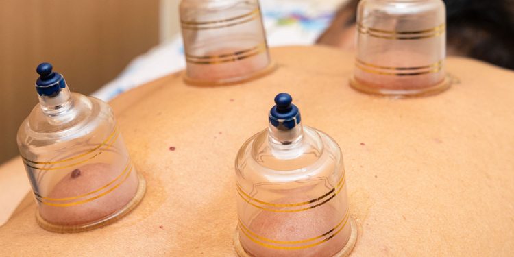 Vacuum Therapy and Acupressure