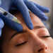 Dermal Fillers