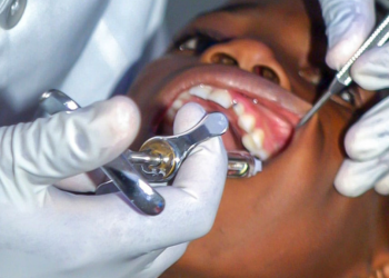 Emergency Tooth Extractions