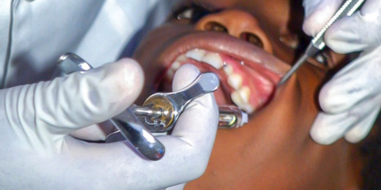 Emergency Tooth Extractions