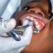 Emergency Tooth Extractions