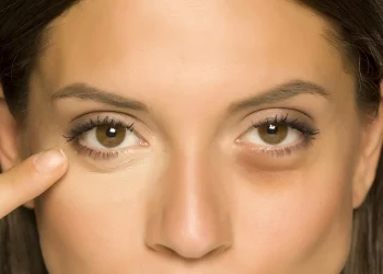 Get Rid Of Bags Under The Eyes