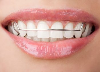 Orthodontic Appliances