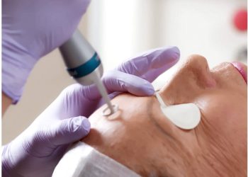 How To Deal With Age Spots