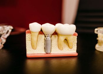 Tooth Implant