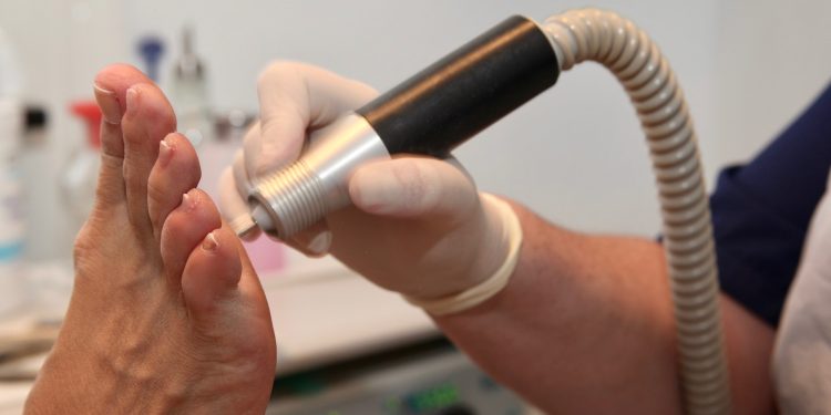 Foot Care From a Local Podiatrist