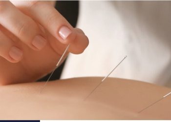 What are the benefits of acupuncture?