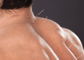 Can Acupuncture Really Ease Anxiety? Here’s What You Should Know