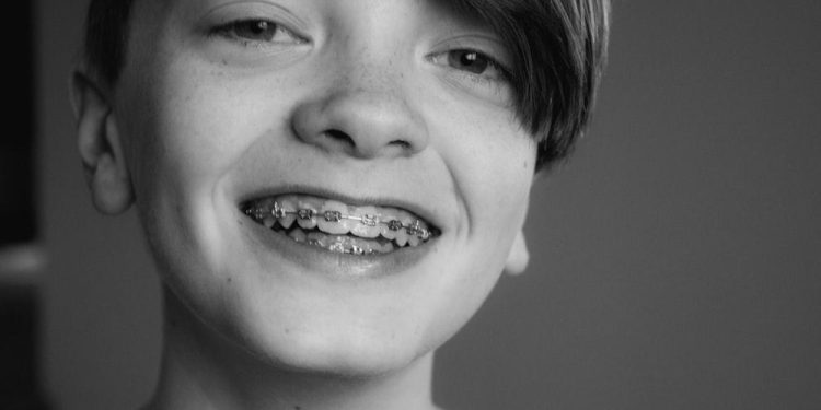 Orthodontic Treatment for Children