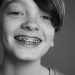 Orthodontic Treatment for Children