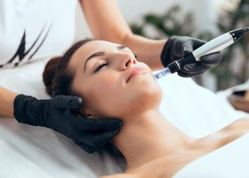 Microneedling for Acne Scars