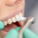 Cosmetic Dentistry