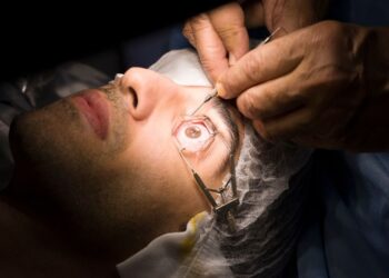 LASIK Surgery