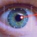 Revolutionizing Vision: Breakthroughs in Laser Eye Surgery and Lens Implants in Sydney