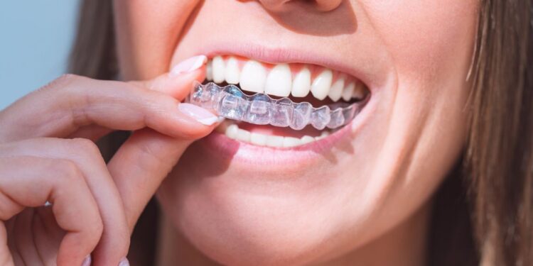 Invisalign