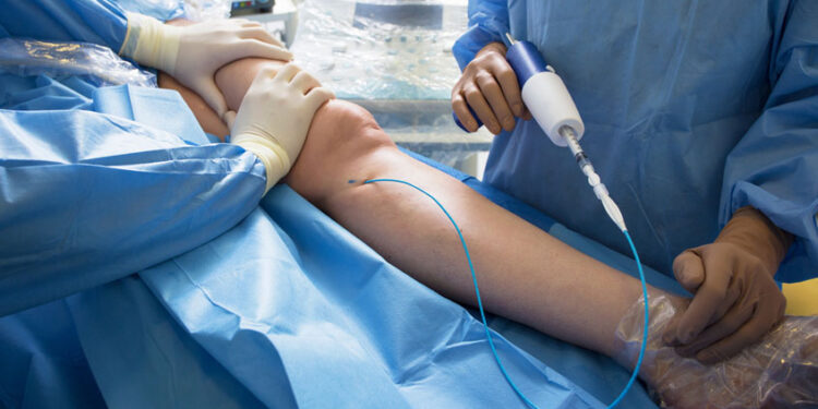 Right Vascular Physician