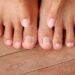 Hallux Limitus and Hallux Rigidus