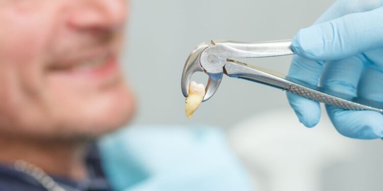 Tooth Extraction Appointment