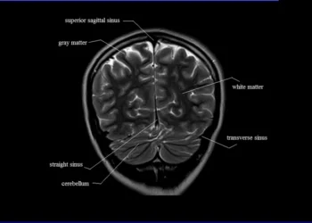 MRI Brain Anatomy