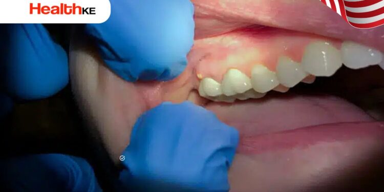 How Long Until A Tooth Infection Kills You