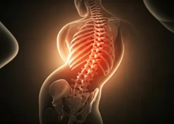 Scoliosis Affect the Nervous System