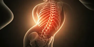 Scoliosis Affect the Nervous System