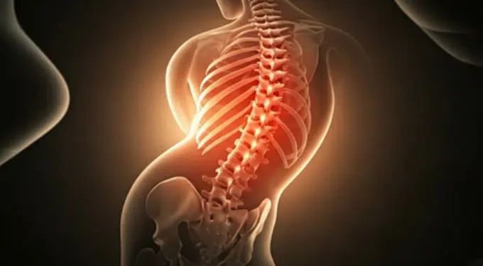 Scoliosis Affect the Nervous System