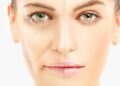 Facial Rejuvenation