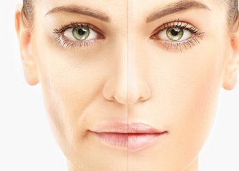 Facial Rejuvenation