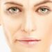 Facial Rejuvenation