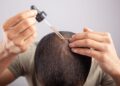 Hair Transplant Maintenance and Care