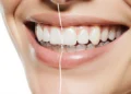 Best Invisalign Clear Aligners Dentist in Southern California